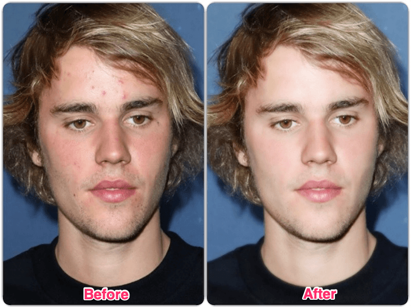 Hình ảnh trước và sau khi chỉnh sửa
